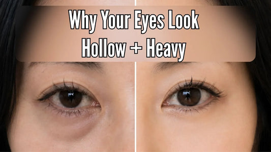 Close-up comparison of hollow, tired-looking eyes and brighter, refreshed eyes, illustrating why eyes can look hollow and heavy at the same time.