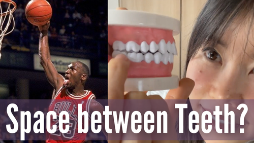 Thumbnail for 'Why You Should Keep Space Between Upper And Lower Teeth', highlighting the importance and benefits of maintaining a gap between the teeth for oral health.