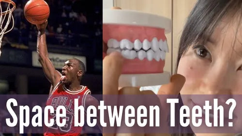 Thumbnail for 'Why You Should Keep Space Between Upper And Lower Teeth', highlighting the importance and benefits of maintaining a gap between the teeth for oral health.