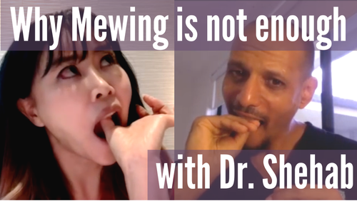 Thumbnail for a blog post titled 'Why Mewing Is Not Good Enough By Dr. Shehab', featuring critical insights on the limitations of the mewing technique for facial structure improvement.