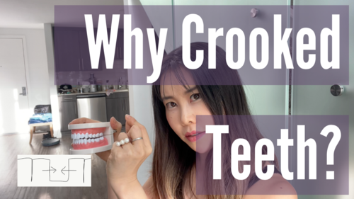 Thumbnail for 'Why Teeth Are Crooked', delving into the causes of misaligned teeth and potential corrective measures.