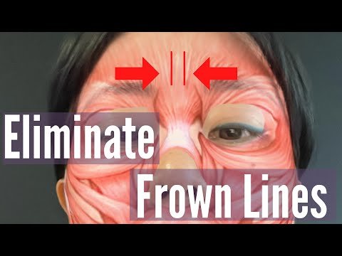 Thumbnail for 'Eliminate Frown Lines', displaying methods and exercises focused on reducing the appearance of deep lines and wrinkles between the eyebrows.