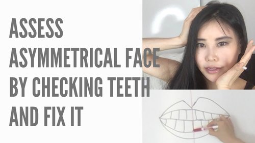 How To Asses Asymmetrical Face With Teeth Alighnment And How To Fix | Chiropractic Technique