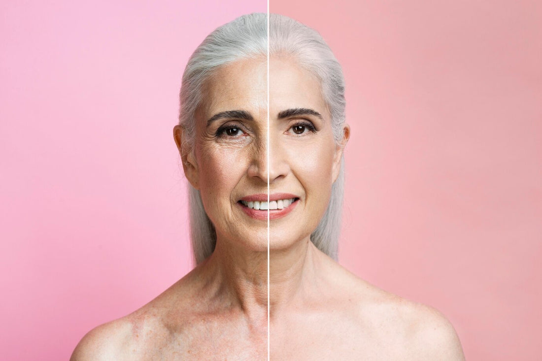 Woman’s face before and after demonstrating wrinkle reduction and youthful appearance with face yoga.