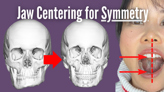 Jaw Centering for Symmetry