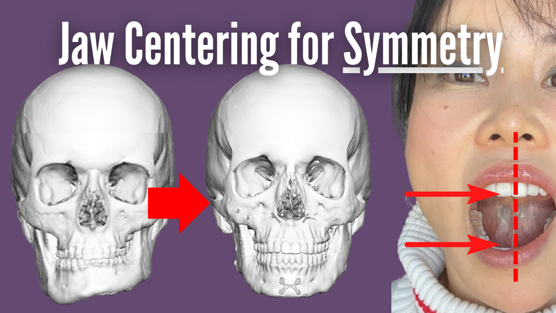 Thumbnail for 'Jaw Centering for Symmetry', visually illustrating techniques to align the jaw for facial balance and symmetry.