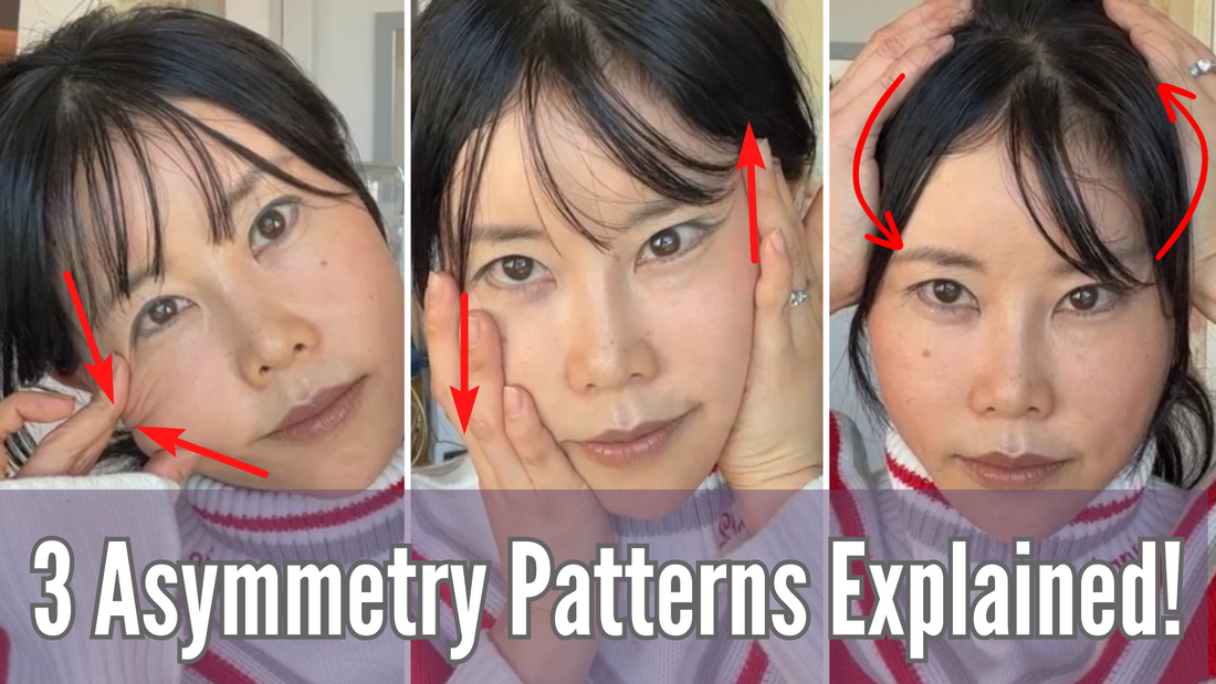 3 Kinds of Facial Asymmetry Pattern
