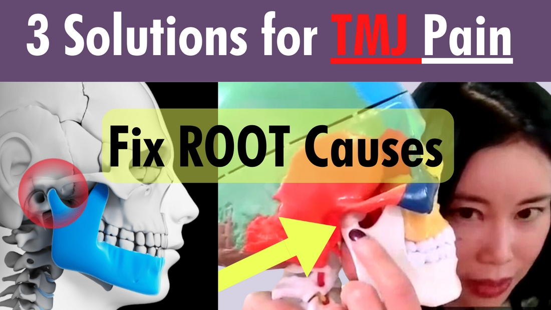 Thumbnail image featuring '3 Solutions for TMJ Pain', visually summarizing key methods for alleviating temporomandibular joint discomfort.