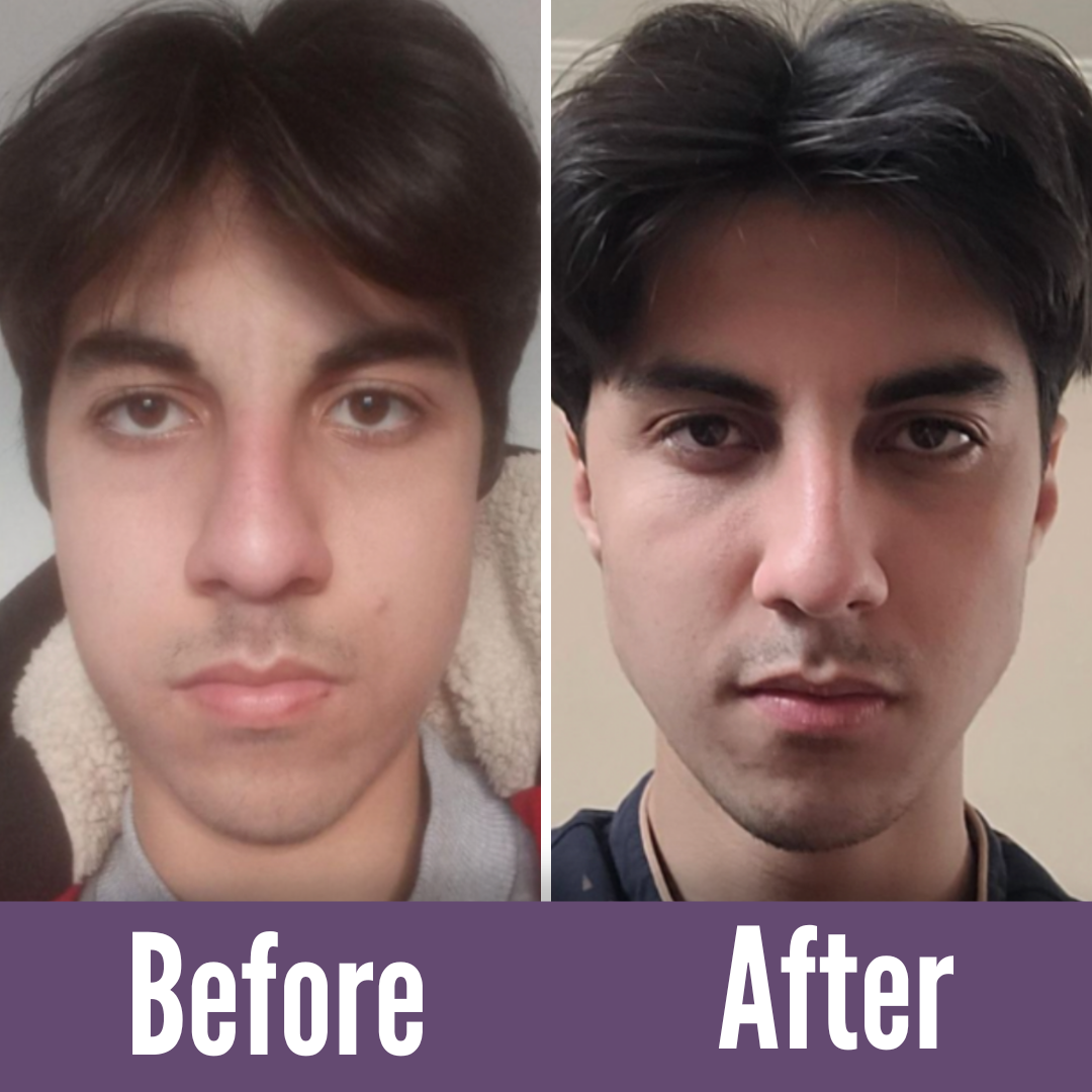 The natural solution to regain your youthful appearance.
