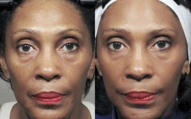 Koko Face Yoga Proven Results