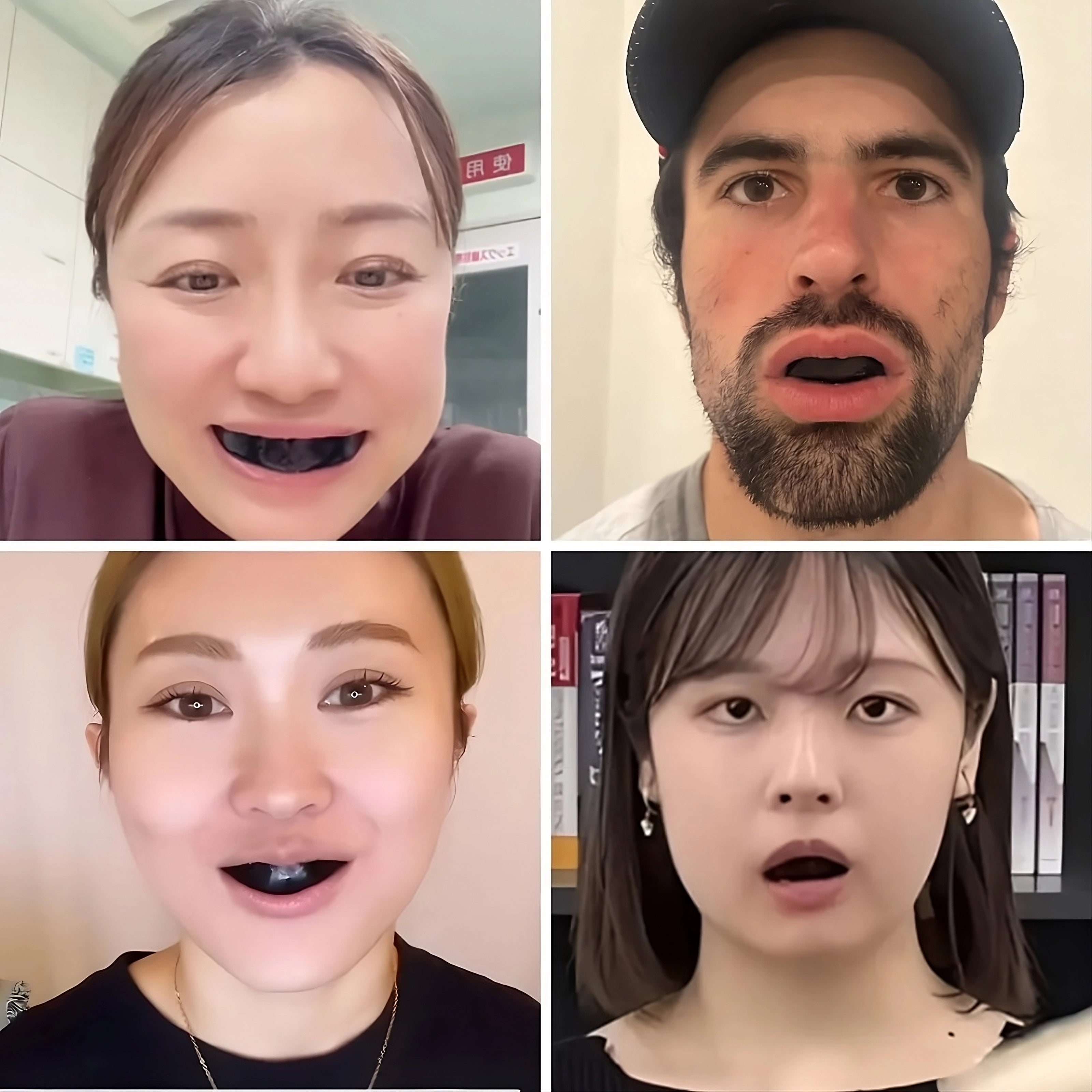 Before and after facial transformation photos showing the effects of using the Facial Aligner.