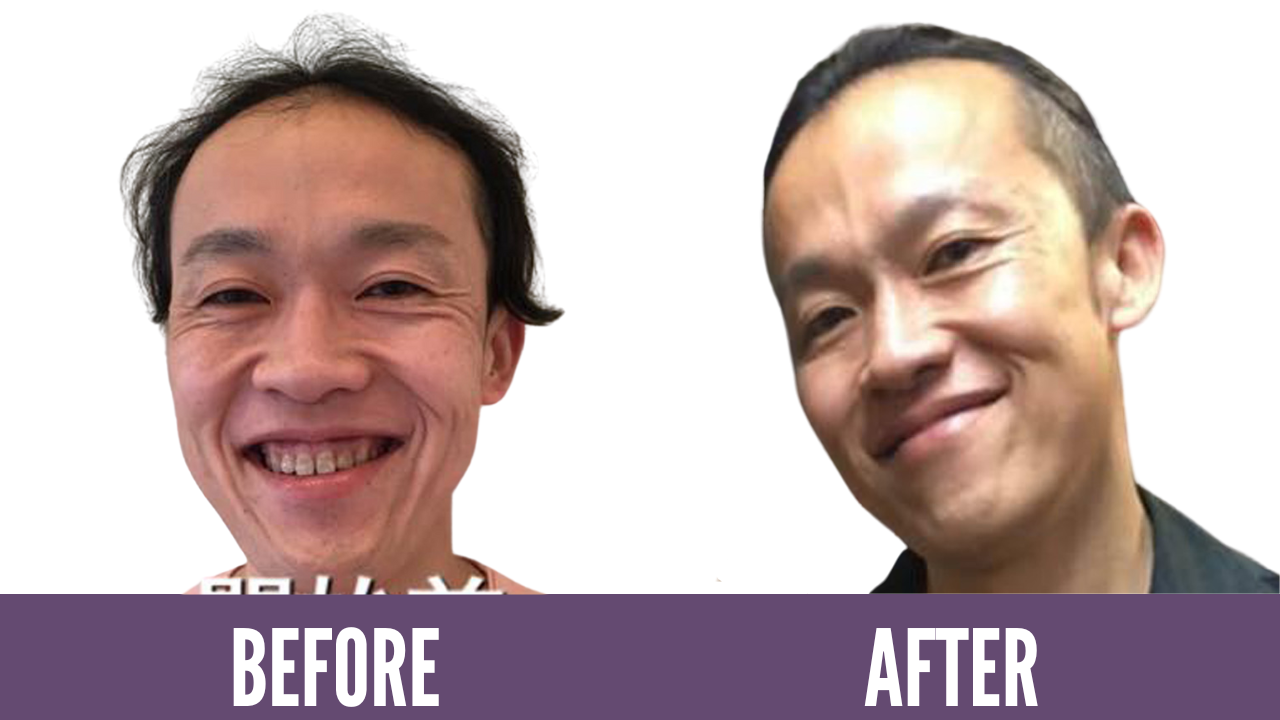 Face Yoga result only in 1 year