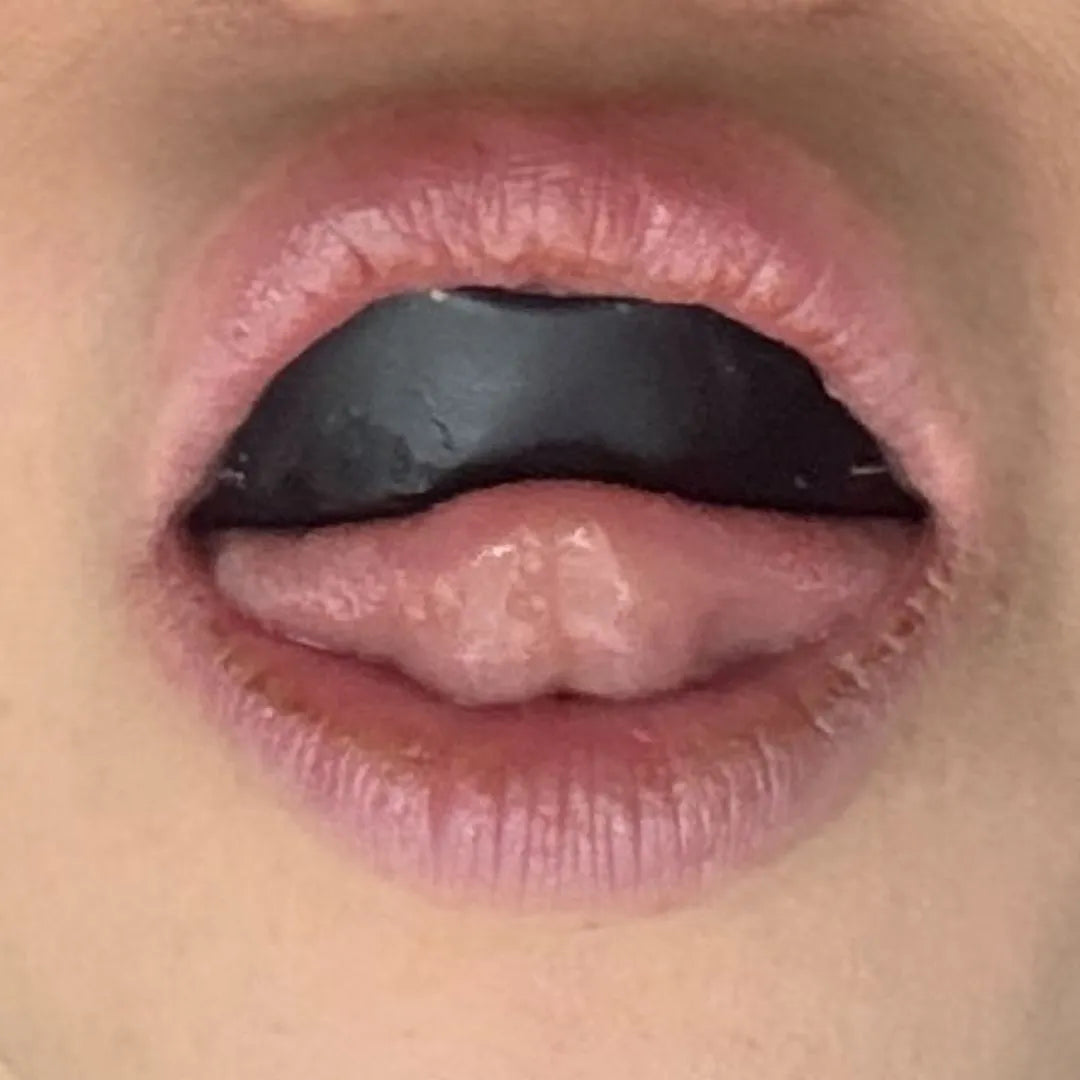 Close-up of mouth with black Essential facial aligner inserted, demonstrating Step 2 of Koko Face Yoga muscle activation exercise.