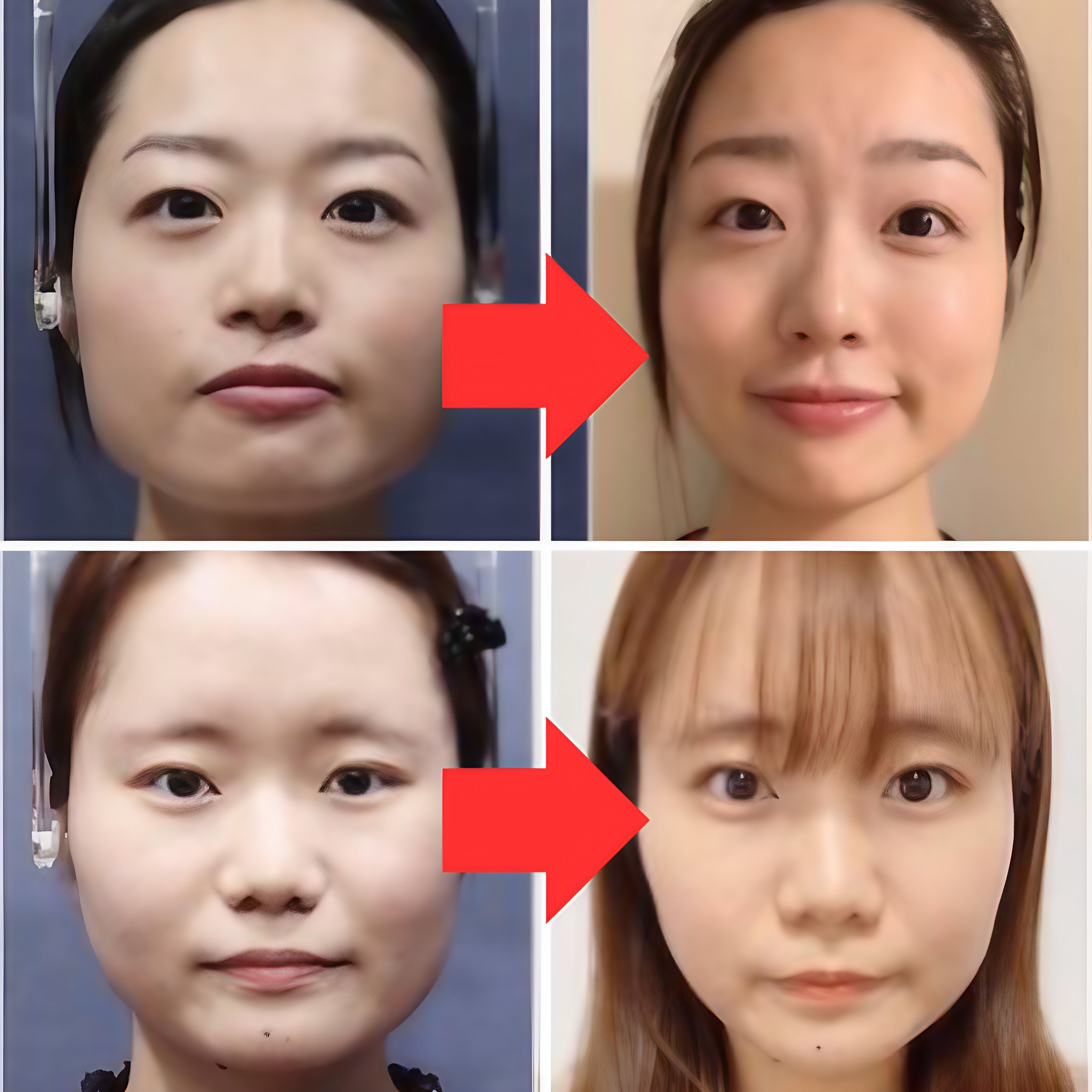 Before and after facial transformation photos showing the effects of using the Facial Aligner.