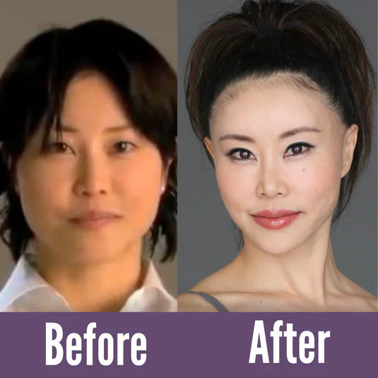 Before and after images from a Japanese book press release on Koko Face Yoga, showing the effectiveness of mewing techniques in reducing double chin.