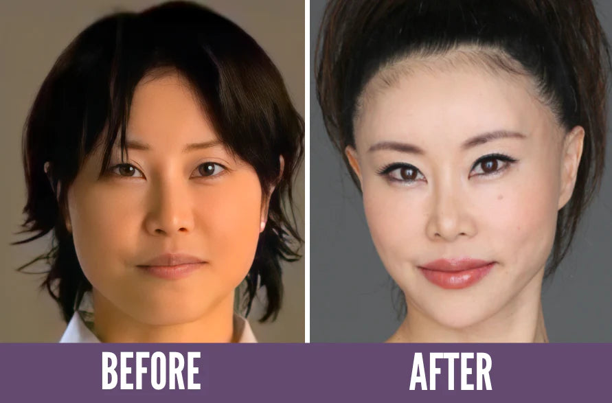 Before & After Photos Showing Results Of Koko Face Yoga 