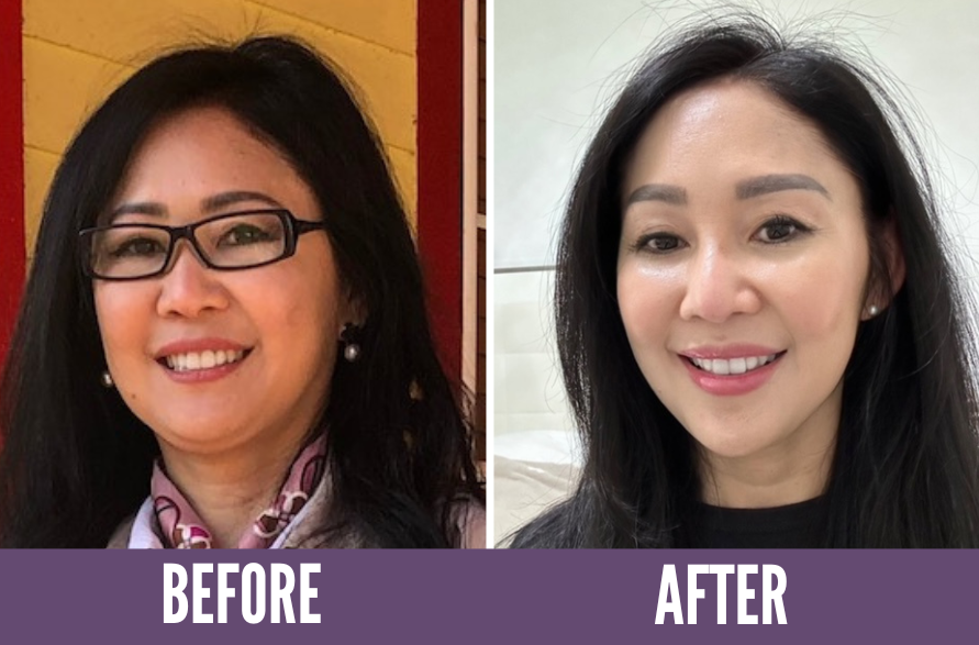 Before and after images demonstrating the transformative effects of Koko Face Yoga on a woman, showing enhanced facial symmetry, smoother skin, and a more youthful appearance.