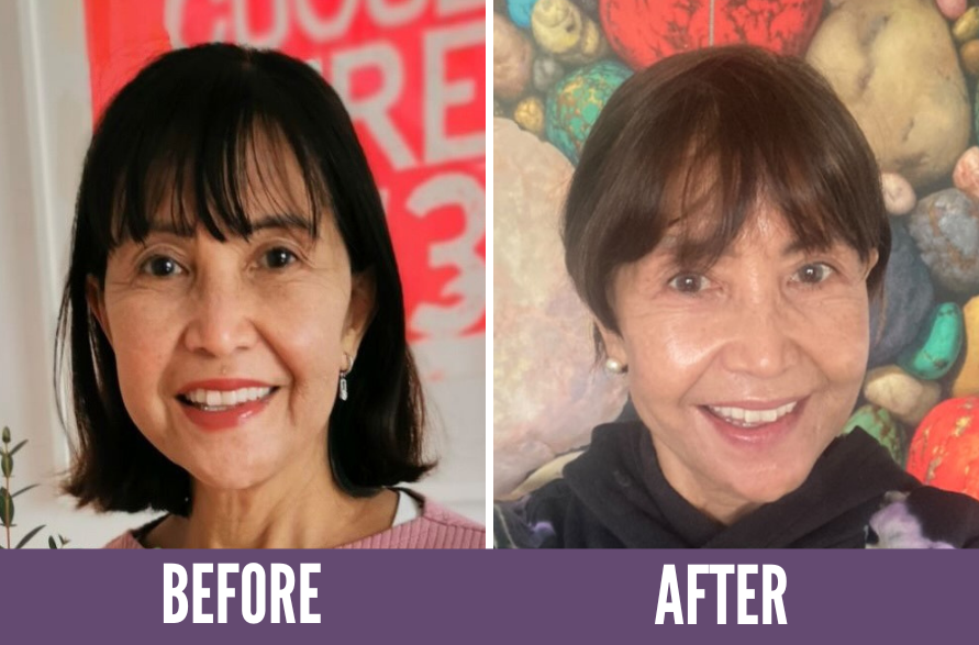 Before and after photos showing the results of Koko Face Yoga on a woman, highlighting a more radiant complexion and improved skin tone, demonstrating the effectiveness of the face yoga techniques.