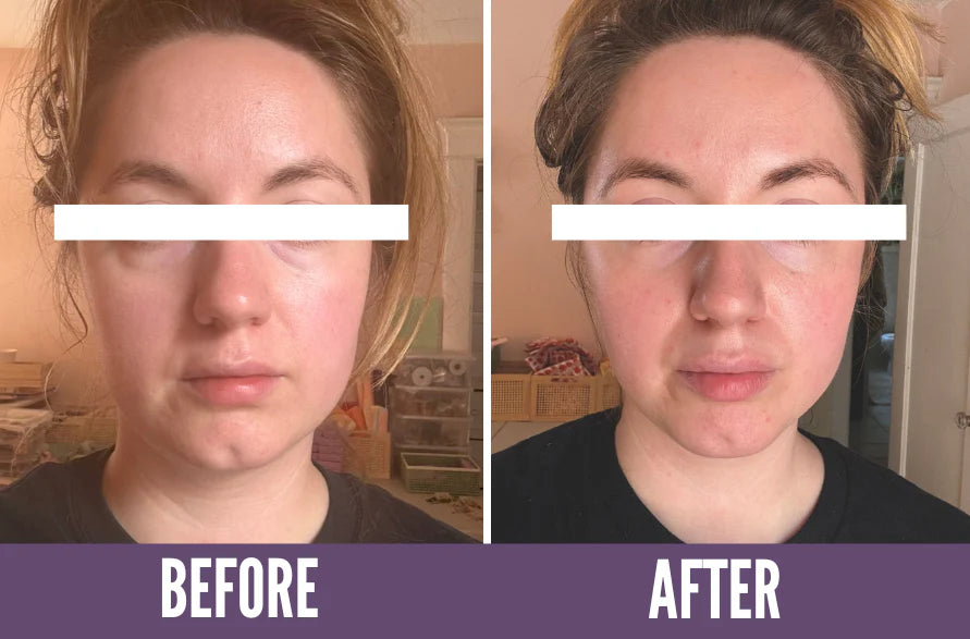 Before and after comparison photo showcasing the effects of Koko Face Yoga, highlighting noticeable improvements in facial symmetry, skin tone, and overall facial structure after practicing face yoga.