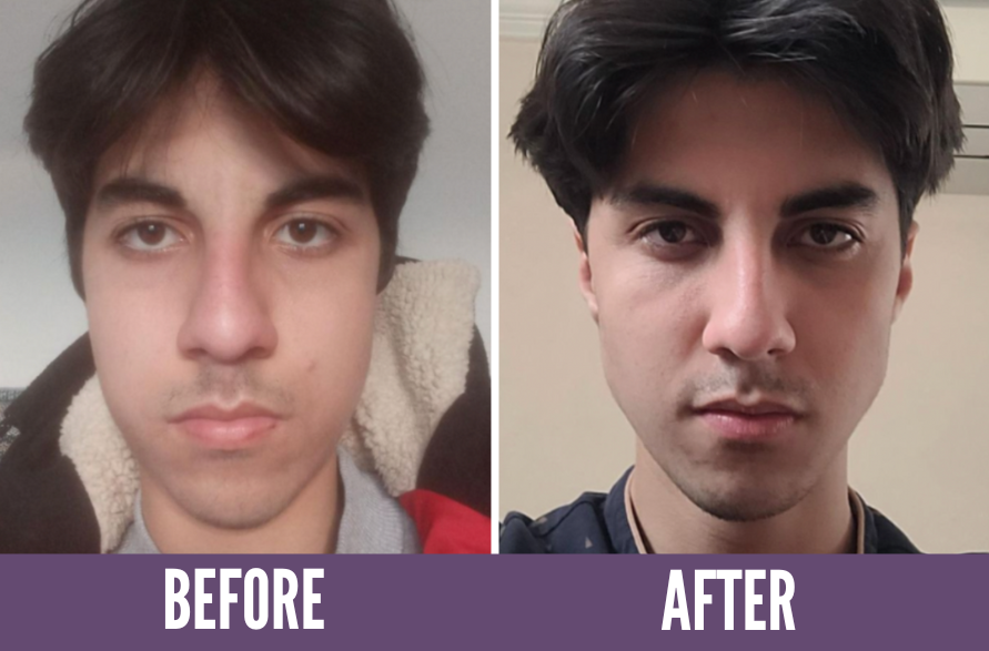 Face yoga before after hotsell