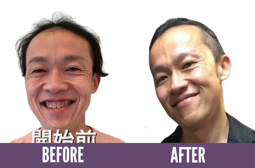 Face Yoga result only in 1 year