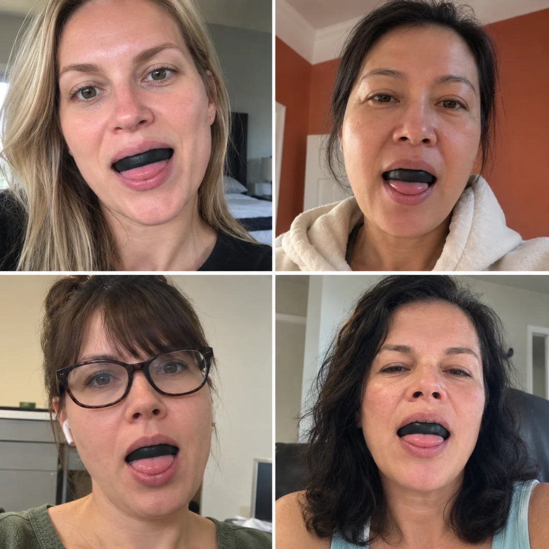 A four-panel collage showing four different women with Koko Face Yoga mouthguards or dental trays fitted inside their mouths, photographed in casual indoor settings